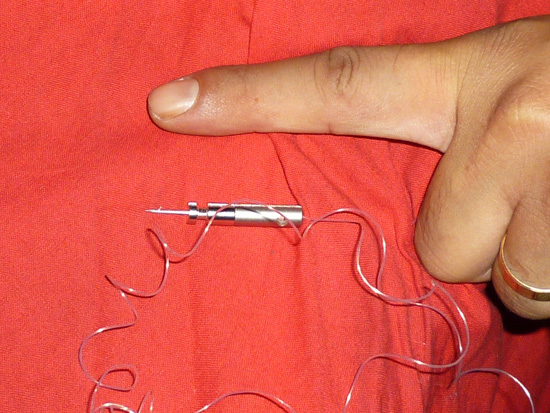 경찰이 쏜 테이저건